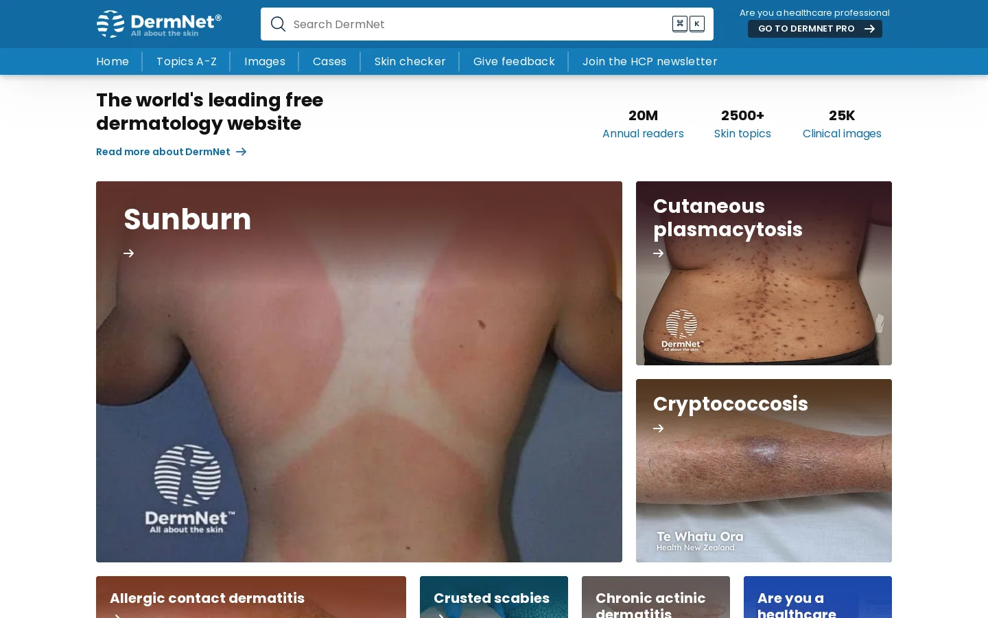 DermNet Homepage screenshot