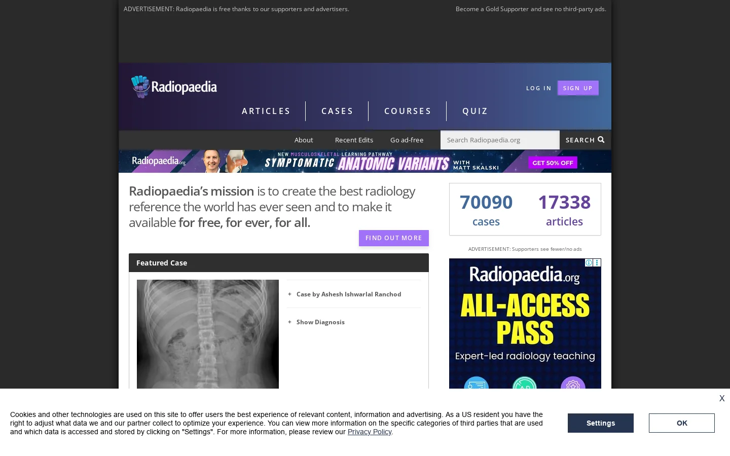 Radiopaedia.org, the peer-reviewed collaborative radiology resource Homepage screenshot